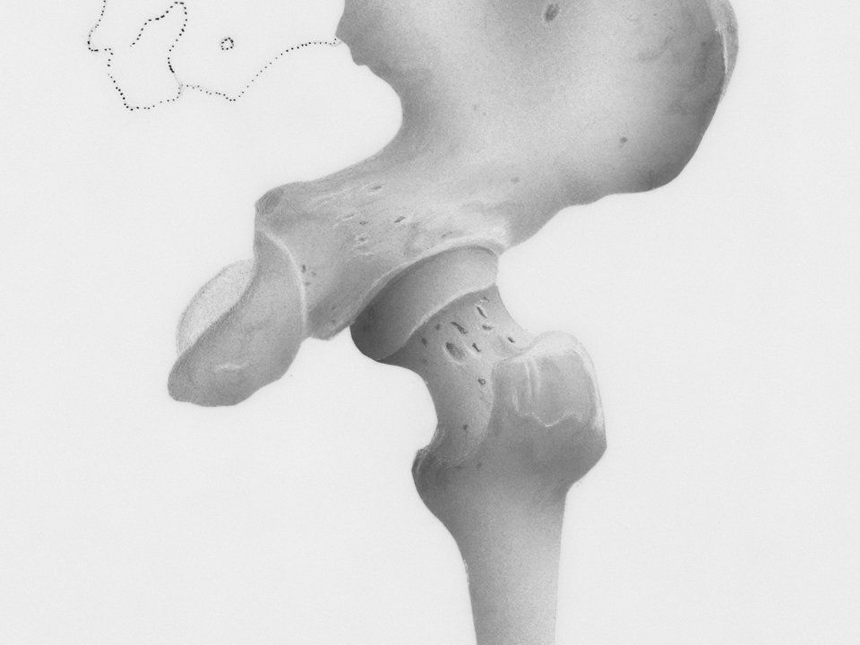 Sacroiliac Joint Dysfunction &mdash; interventional pain care at Axis Pain Group