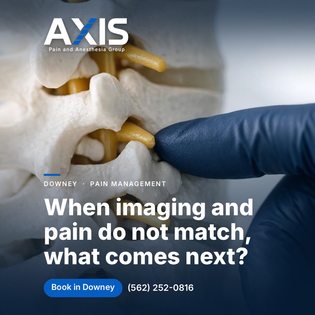 When imaging and pain do not match, what comes next?